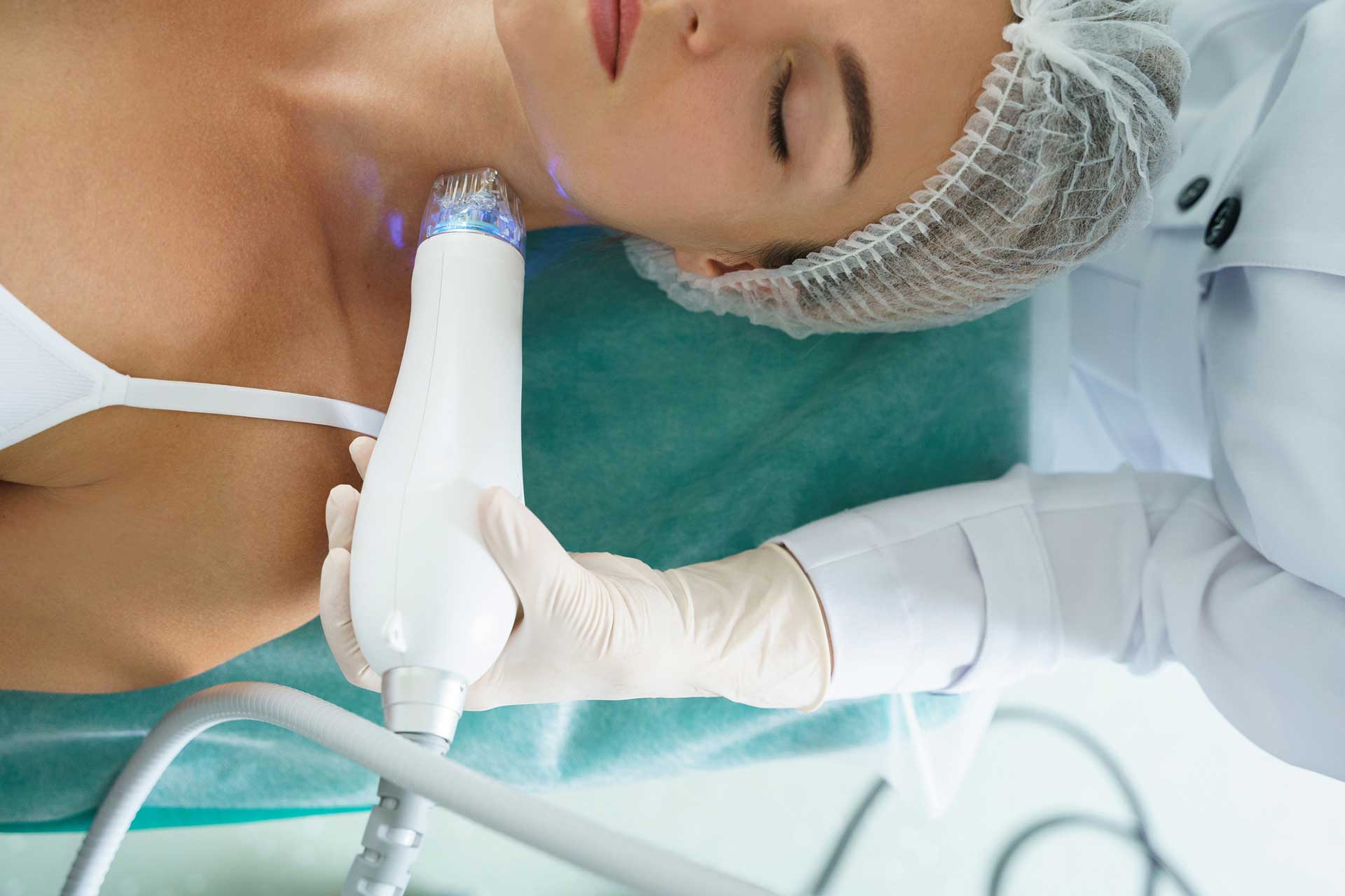 RF Microneeling Microneedling Behandlungen in Wien